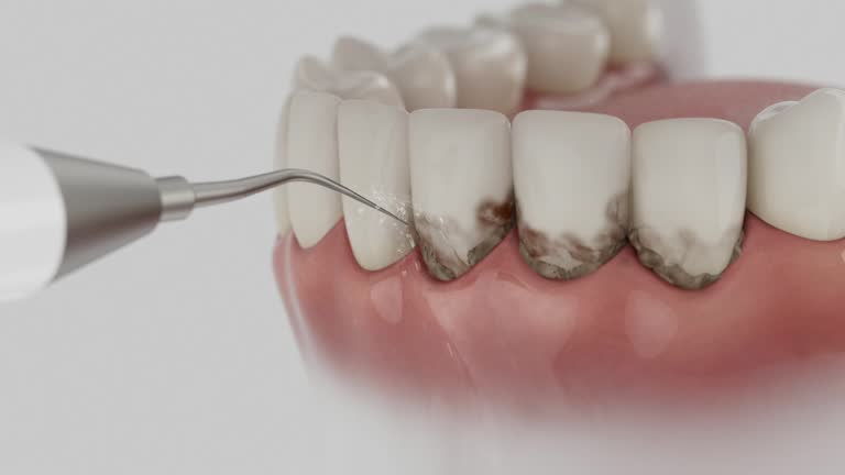 Reliable Dental Implants contractor in Preston, MN by Smile Center Dentistry